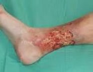 DERMA KURE CREAM