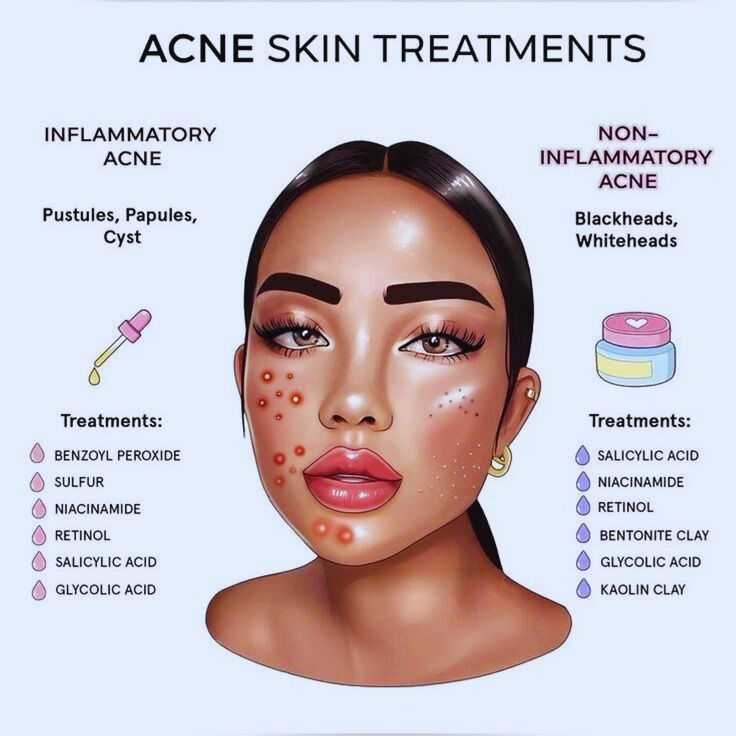 Acne