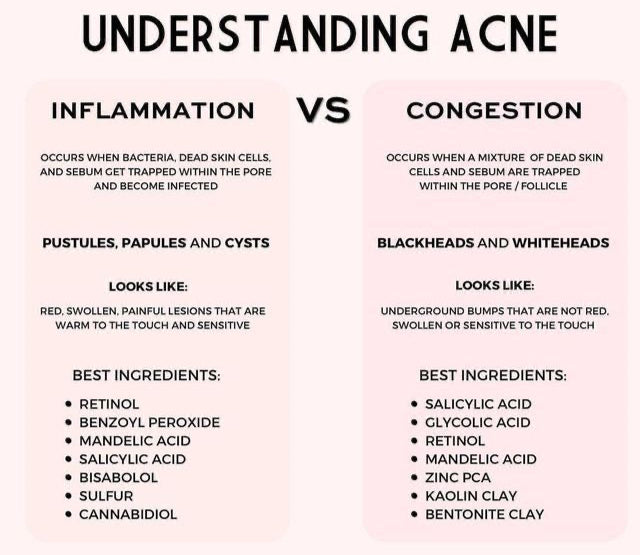 Comparison chart between inflammation and congestion acne, with ingredients listed for each type of acne, from The Dallas Aesthetician.
