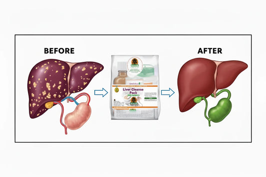 Natural Liver cleanse pack
